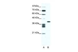 ALX4 Antibody, Novus Biologicals 100 &mu;L | Buy Online | Novus Biologicals | Fisher Scientific
